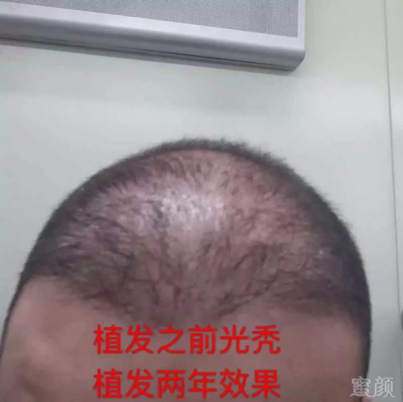 https://img.miyanlife.com/mnt/timg/171221/10502430C-11.jpg