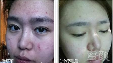 https://img.miyanlife.com/mnt/timg/171221/114S41131-12.jpg