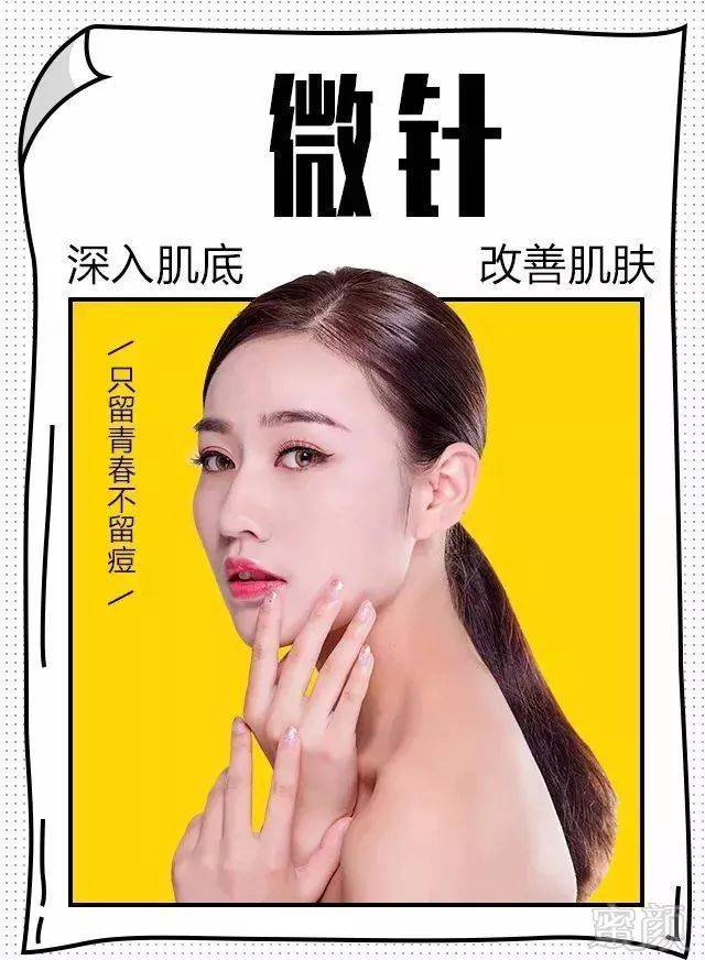 https://img.miyanlife.com/mnt/timg/171221/11511241U-3.jpg