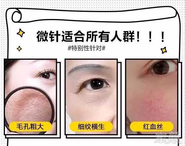 https://img.miyanlife.com/mnt/timg/171221/1151124292-4.jpg