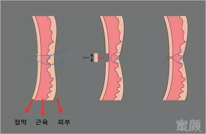 案例图片