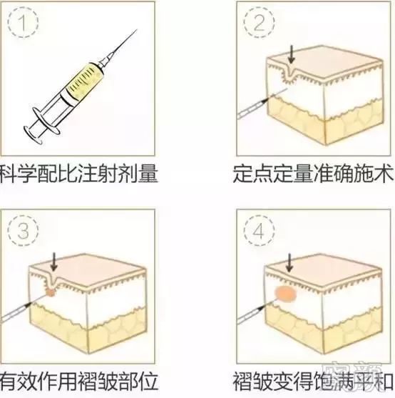 案例图片