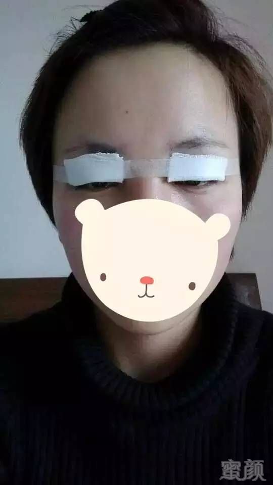 https://img.miyanlife.com/mnt/timg/171221/12041GZ1-1.jpg
