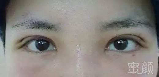https://img.miyanlife.com/mnt/timg/171221/12041T954-4.jpg