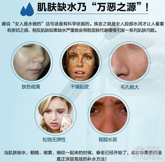 https://img.miyanlife.com/mnt/timg/171221/125221F05-4.jpg