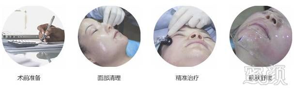 https://img.miyanlife.com/mnt/timg/171221/1252223608-9.jpg
