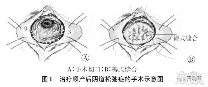 https://img.miyanlife.com/mnt/timg/171221/1311525a6-6.jpg