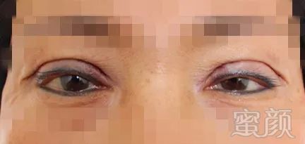 https://img.miyanlife.com/mnt/timg/171221/132109E23-3.jpg