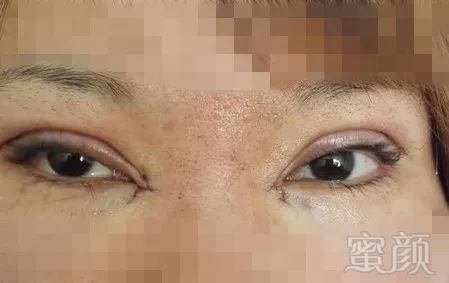 https://img.miyanlife.com/mnt/timg/171221/13210V026-1.jpg