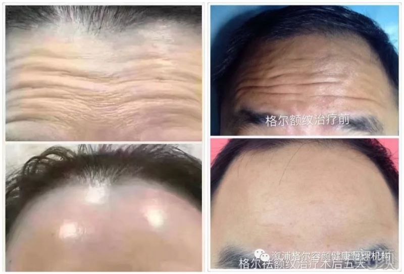 https://img.miyanlife.com/mnt/timg/171222/11023I129-7.jpg