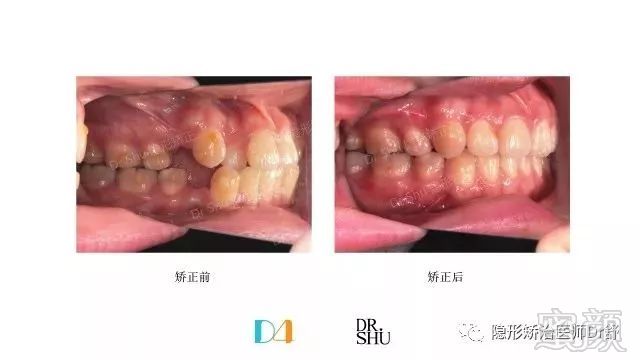 https://img.miyanlife.com/mnt/timg/171222/11115011W-7.jpg