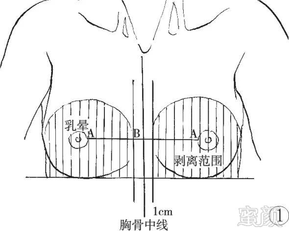 案例图片