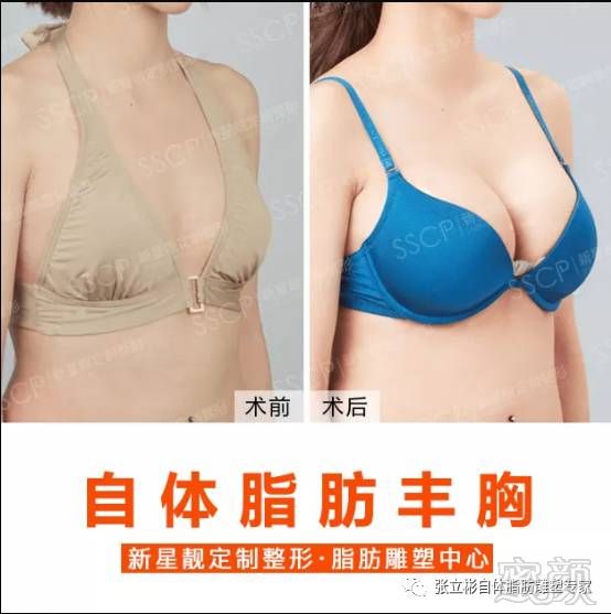 https://img.miyanlife.com/mnt/timg/171222/111I23521-1.jpg
