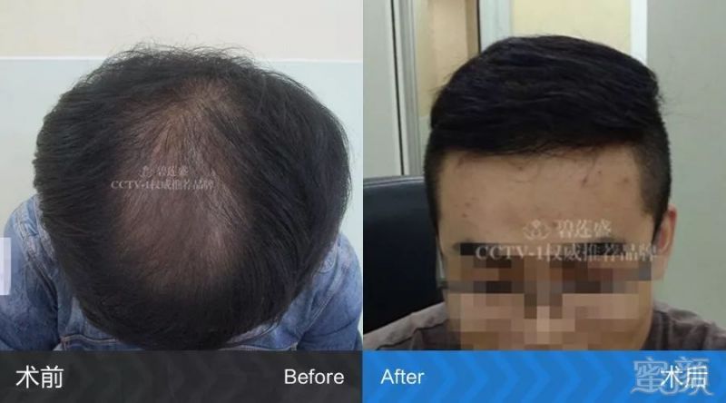 https://img.miyanlife.com/mnt/timg/171222/12533MW1-2.jpg