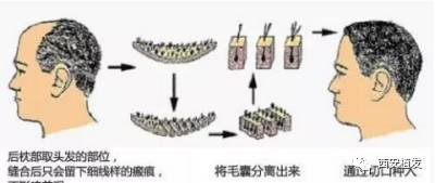 https://img.miyanlife.com/mnt/timg/171222/1254022132-0.jpg