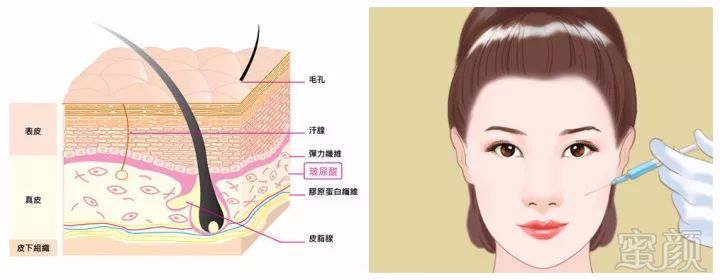 https://img.miyanlife.com/mnt/timg/171222/1255324119-0.jpg