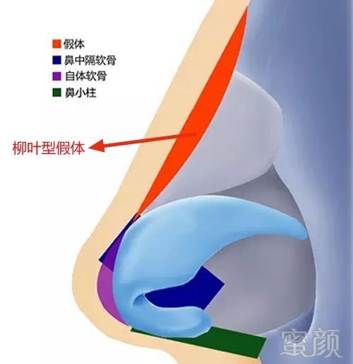 案例图片