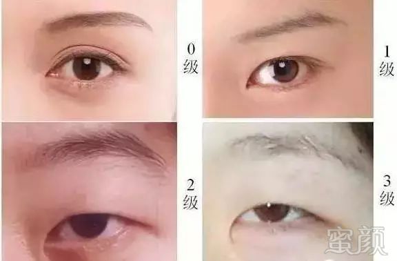 https://img.miyanlife.com/mnt/timg/171222/135H55a6-4.jpg