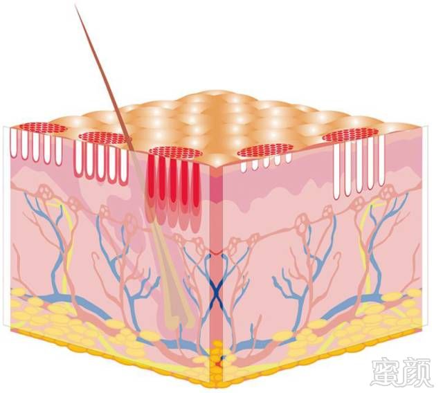 案例图片