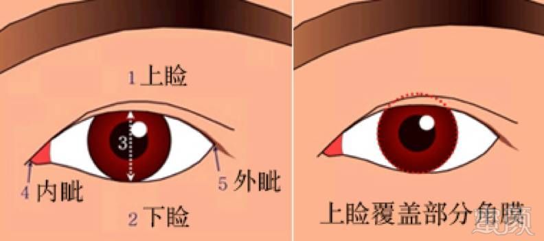 https://img.miyanlife.com/mnt/timg/171222/1433334047-2.jpg