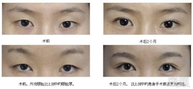 https://img.miyanlife.com/mnt/timg/171222/1433343053-7.jpg
