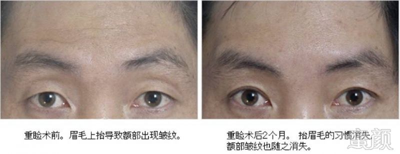 https://img.miyanlife.com/mnt/timg/171222/1433345443-6.jpg