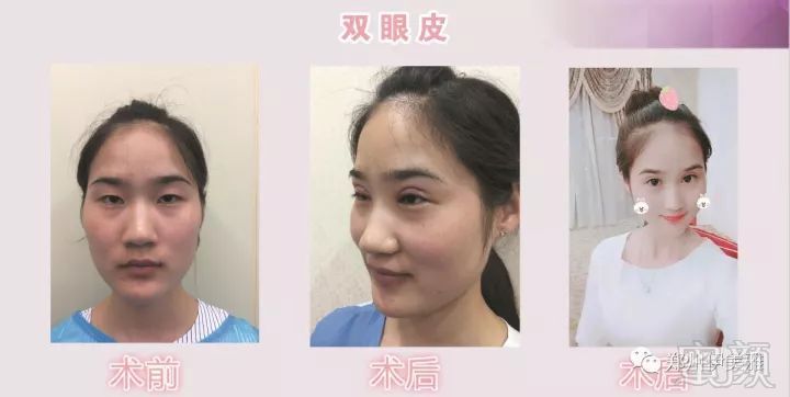 https://img.miyanlife.com/mnt/timg/171223/111Z51G3-8.jpg