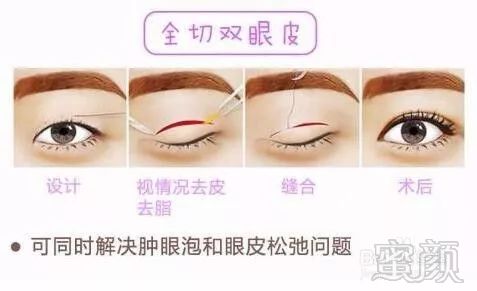 https://img.miyanlife.com/mnt/timg/171223/111Z55417-4.jpg
