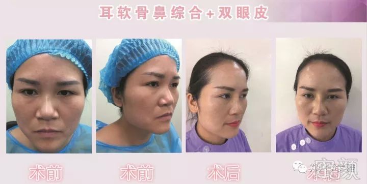 https://img.miyanlife.com/mnt/timg/171223/111Z62404-9.jpg