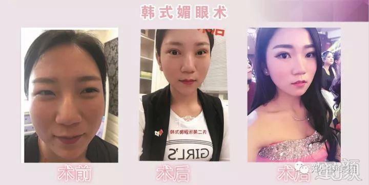 https://img.miyanlife.com/mnt/timg/171223/111Z64958-12.jpg