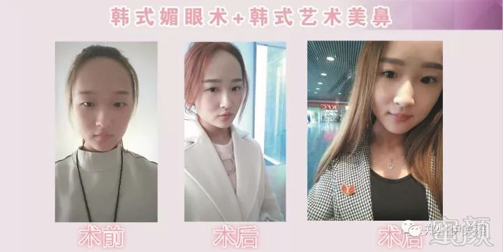 https://img.miyanlife.com/mnt/timg/171223/111ZB4R-11.jpg