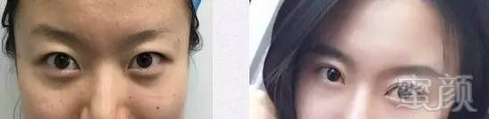 https://img.miyanlife.com/mnt/timg/171223/111ZG5B-13.jpg