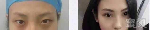 https://img.miyanlife.com/mnt/timg/171223/111ZH013-14.jpg