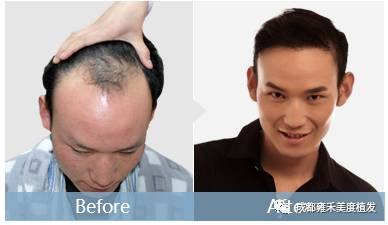 https://img.miyanlife.com/mnt/timg/171223/12460TC4-1.jpg