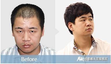 https://img.miyanlife.com/mnt/timg/171223/12460U963-2.jpg