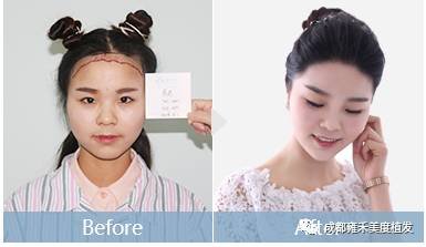 https://img.miyanlife.com/mnt/timg/171223/12460Uc5-3.jpg