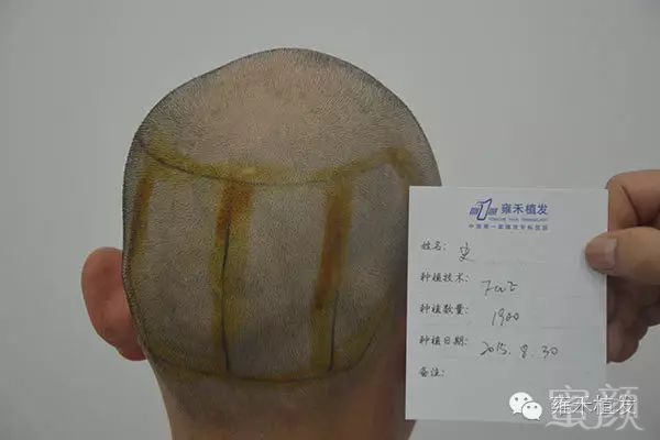 https://img.miyanlife.com/mnt/timg/171223/13034632c-3.jpg