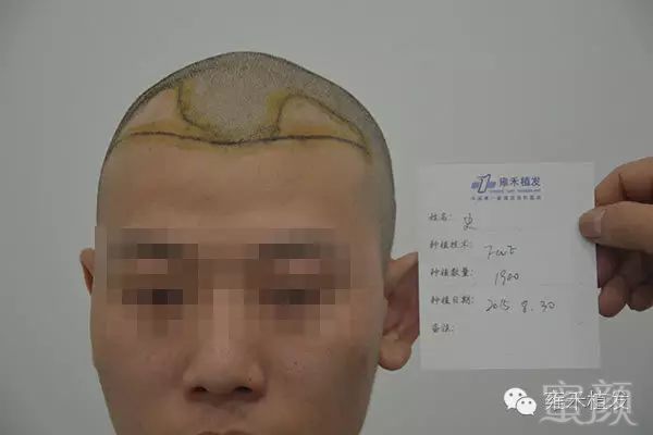 https://img.miyanlife.com/mnt/timg/171223/13034C131-2.jpg