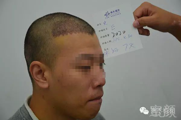 https://img.miyanlife.com/mnt/timg/171223/13034J461-7.jpg