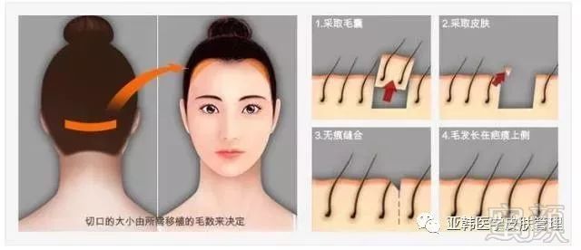https://img.miyanlife.com/mnt/timg/171223/1405413208-0.jpg