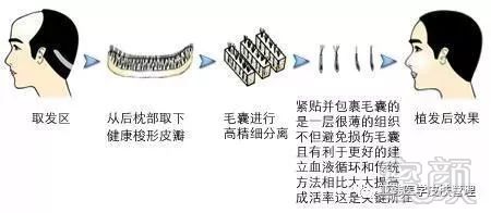 https://img.miyanlife.com/mnt/timg/171223/1405435233-9.jpg