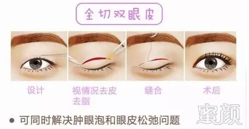 https://img.miyanlife.com/mnt/timg/171223/1421341J3-2.jpg