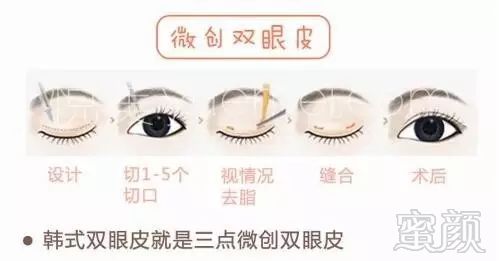 https://img.miyanlife.com/mnt/timg/171223/142134LP-1.jpg