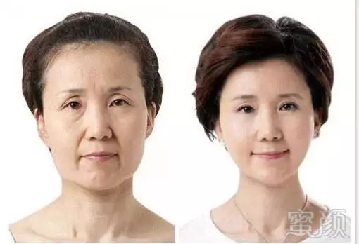 https://img.miyanlife.com/mnt/timg/171224/1316391559-10.jpg