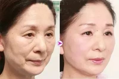 https://img.miyanlife.com/mnt/timg/171224/13163U411-5.jpg