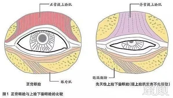 案例图片