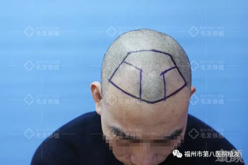 https://img.miyanlife.com/mnt/timg/171224/133P542N-3.jpg