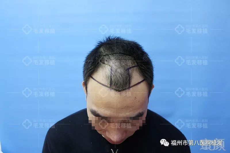 https://img.miyanlife.com/mnt/timg/171224/133P54509-2.jpg