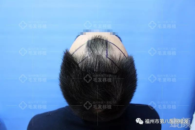 https://img.miyanlife.com/mnt/timg/171224/133P54524-1.jpg