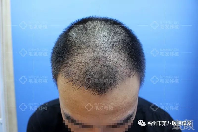 https://img.miyanlife.com/mnt/timg/171224/133PB462-6.jpg